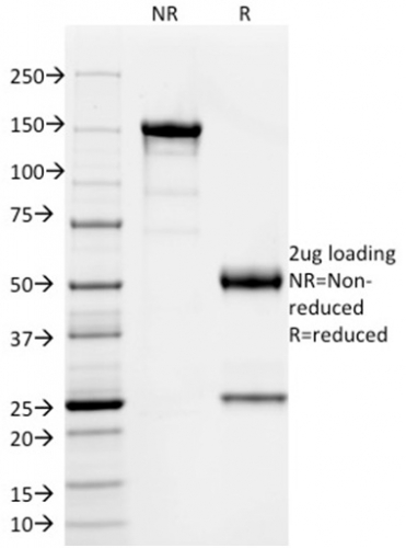 Data from SDS-PAGE analysis of Anti-SOX9 antibody (Clone PCRP-SOX9-1A2). Reducing lane (R) shows heavy and light chain fragments. NR lane shows intact antibody with expected MW of approximately 150 kDa. The data are consistent with a high purity, intact mAb.